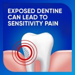 Protect sensitive teeth daily with Sensodyne Daily Care Fluoride Toothpaste 100g. It offers gentle cavity protection and sensitivity relief, keeping your teeth strong, healthy, and feeling fresh every day.